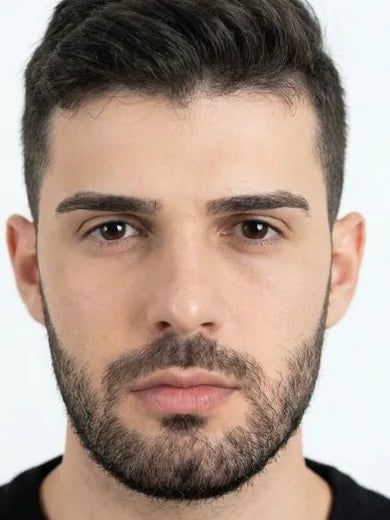Después de usar Apolo